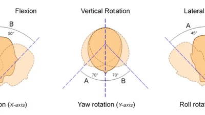 Using Priors to Compensate Geometrical Problems in Head-Mounted Eye Trackers featured image
